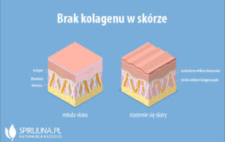 Brak kolagenu w skórze