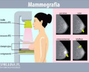 Mammografia