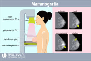 Mammografia