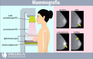 Mammografia