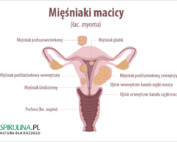 mięśniaki macicy