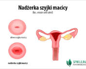 Nadżerka szyjki macicy