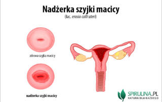 Nadżerka szyjki macicy