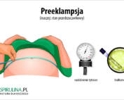 preeklampsja