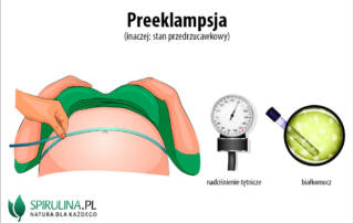 preeklampsja