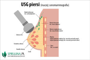 USG piersi