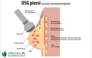 USG piersi