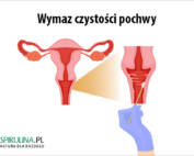 Wymaz czystości pochwy