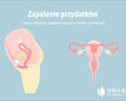 Zapalenie przydatków