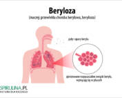 Beryloza
