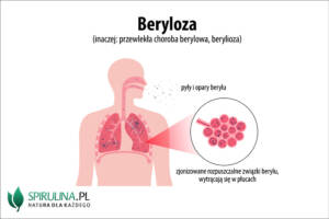 Beryloza