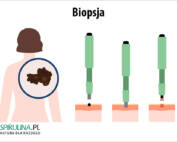 Biopsja
