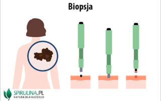 Biopsja