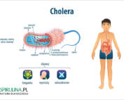 Cholera