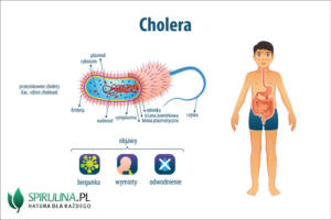 Cholera