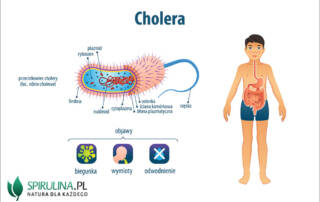 Cholera