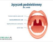 Języczek podniebienny