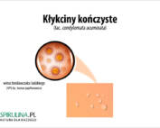 Kłykciny kończyste