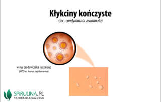 Kłykciny kończyste