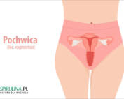 Pochwica