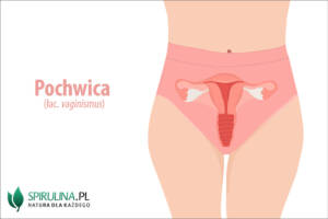 Pochwica