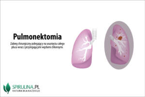 Pulmonektomia