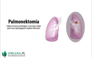 Pulmonektomia