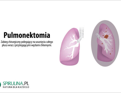 Pulmonektomia