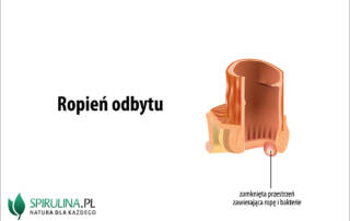 Ropień odbytu