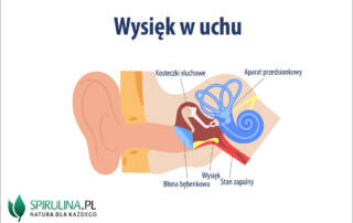 Wysięk w uchu