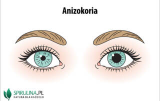 Anizokoria