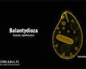 Balantydioza