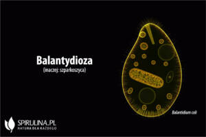 Balantydioza