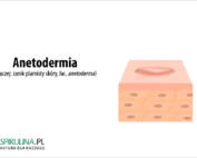 Anetodermia