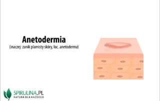 Anetodermia