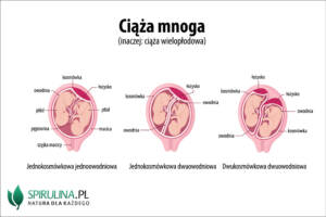 Ciąża mnoga