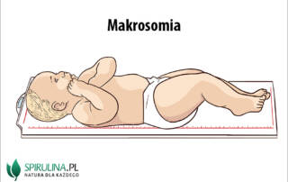 Makrosomia