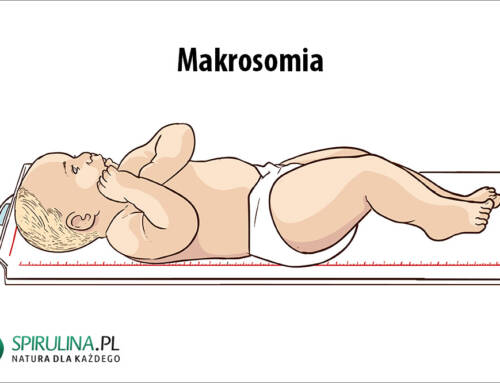 Makrosomia