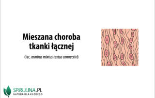 Mieszana choroba tkanki łącznej