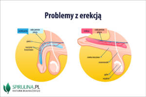 Problemy z erekcją