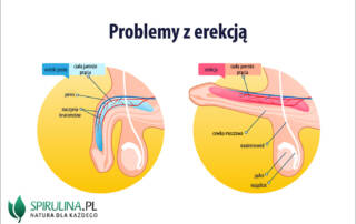 Problemy z erekcją