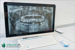 Radiografia cyfrowa