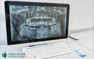 Radiografia cyfrowa