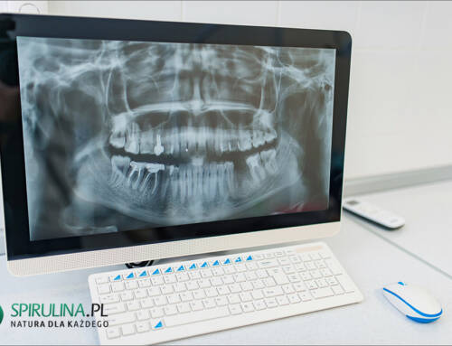 Radiografia cyfrowa