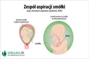 Zespół aspiracji smółki