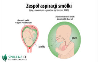 Zespół aspiracji smółki