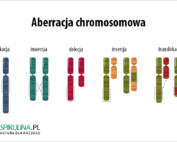 Aberracja chromosomowa