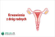 Krwawienia z dróg rodnych
