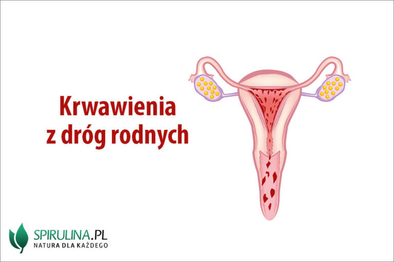 Krwawienia Z Dróg Rodnych U Osób Starszych www.spirulina.pl