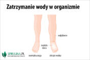 Zatrzymanie wody w organizmie